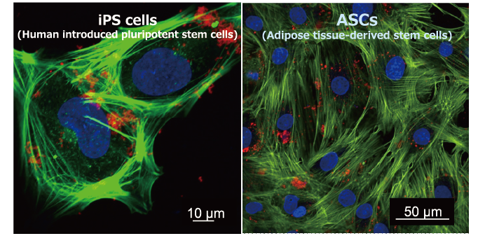 図1 量子ドット（QDs）にて標識されたiPS細胞（左）と脂肪組織由来幹細胞（ASCs）（右）の蛍光画像
